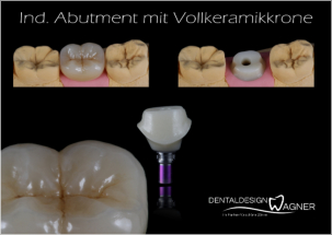 ©Dentaldesign Wagner 