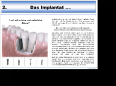 Beispielseite Implantat