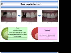 Beispielseite Implantat