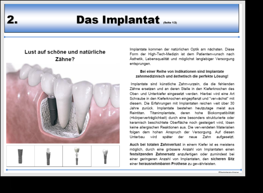 Beispielseite Implantat