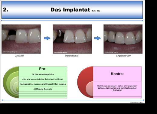 Beispielseite Implantat