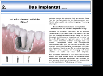 Beispielseite Implantat