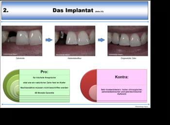 Beispielseite Implantat