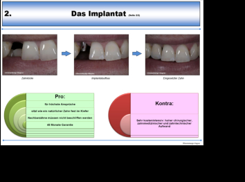 Beispielseite Implantat