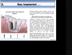 Beispielseite Implantat