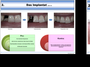 Beispielseite Implantat